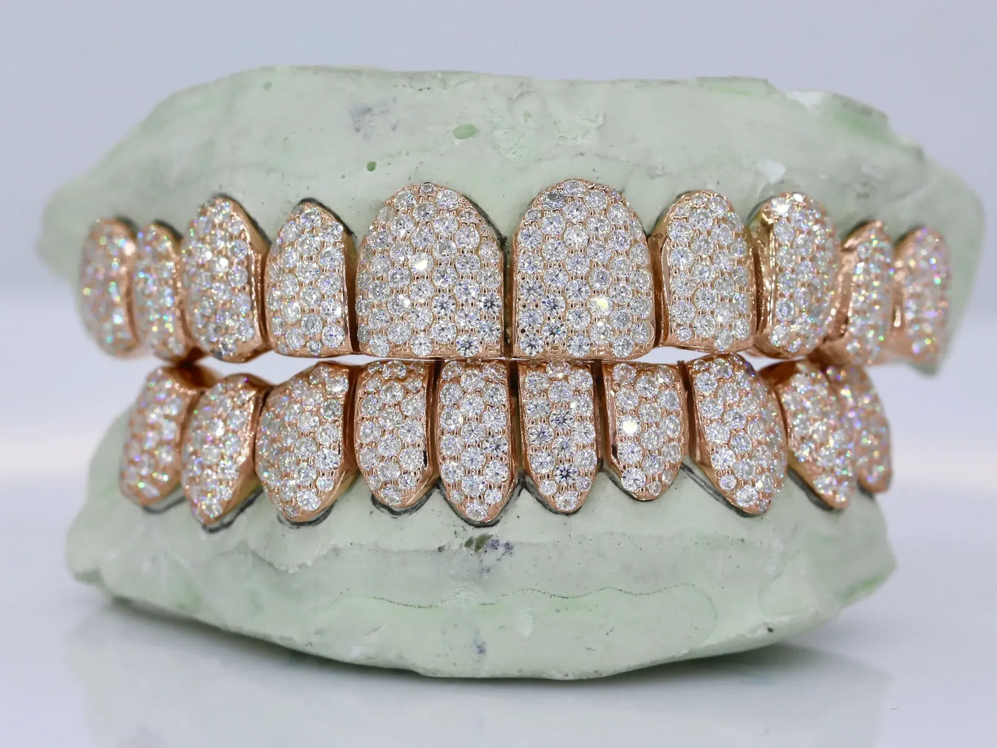 10 on 10 VVS Moissanite Diamond Grillz