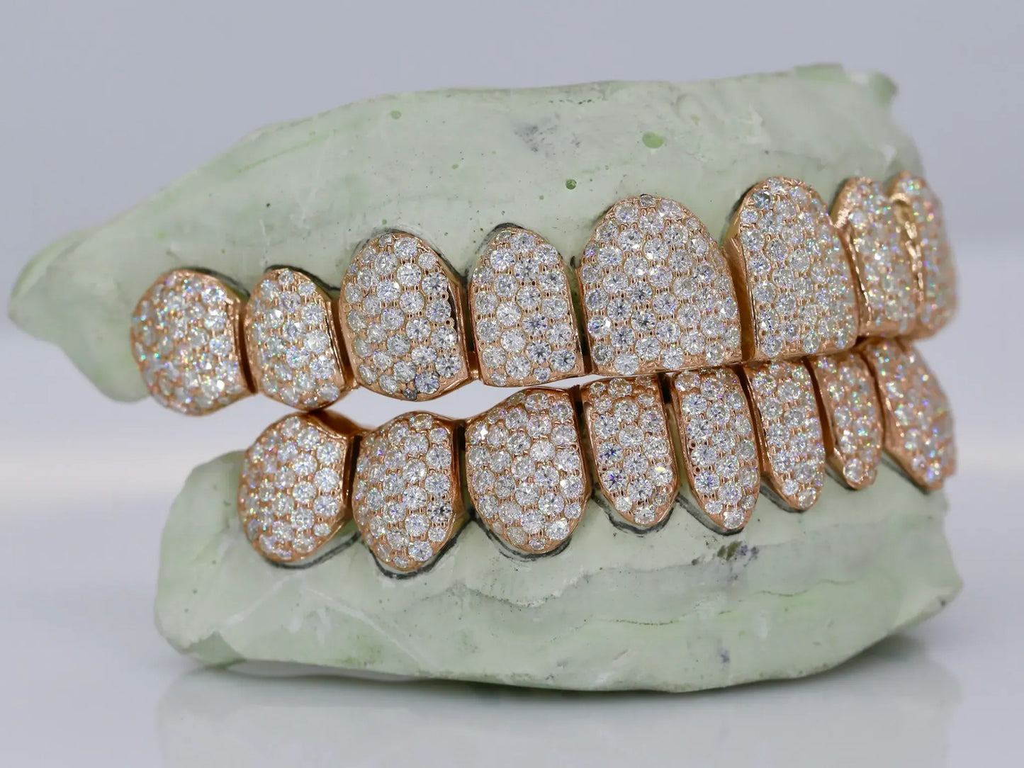 10 on 10 VVS Moissanite Diamond Grillz