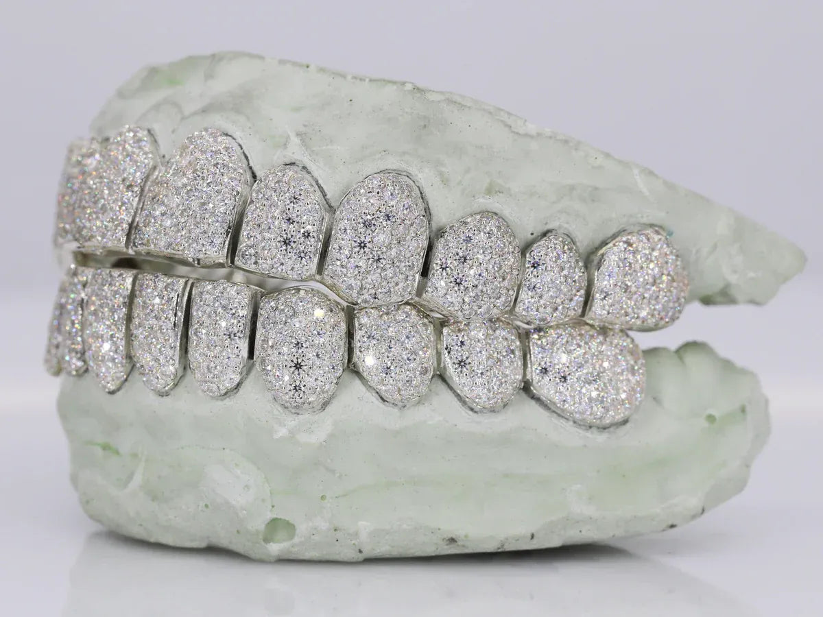 12 on 12 VVS Moissanite Diamond Grillz