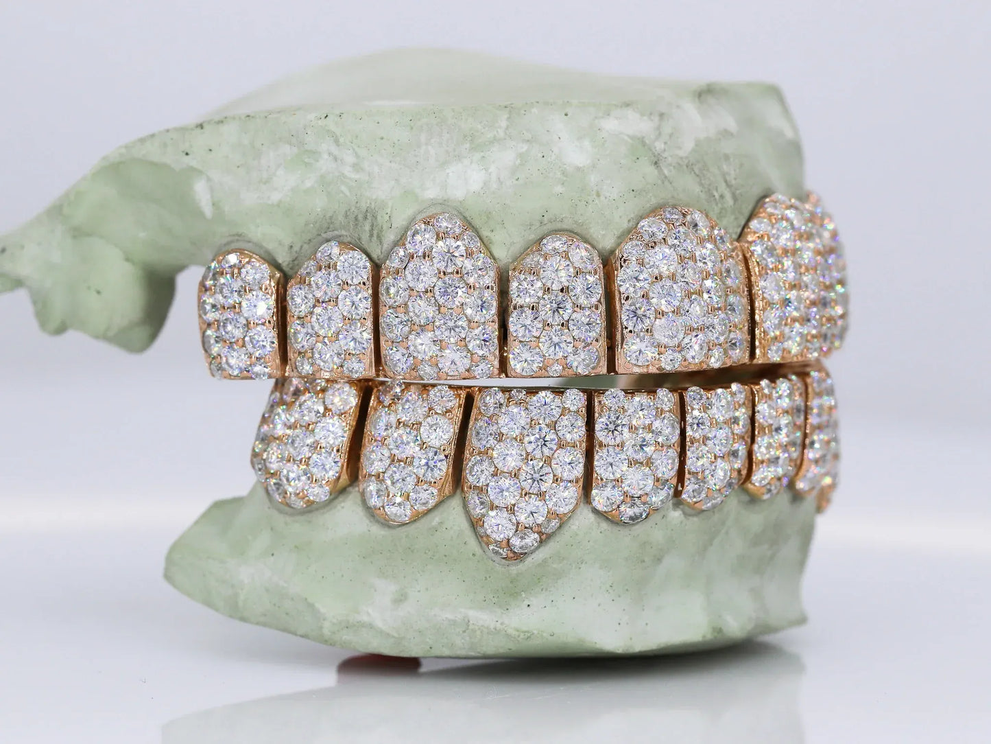 Jumbo VVS Moissanite Diamond Grillz