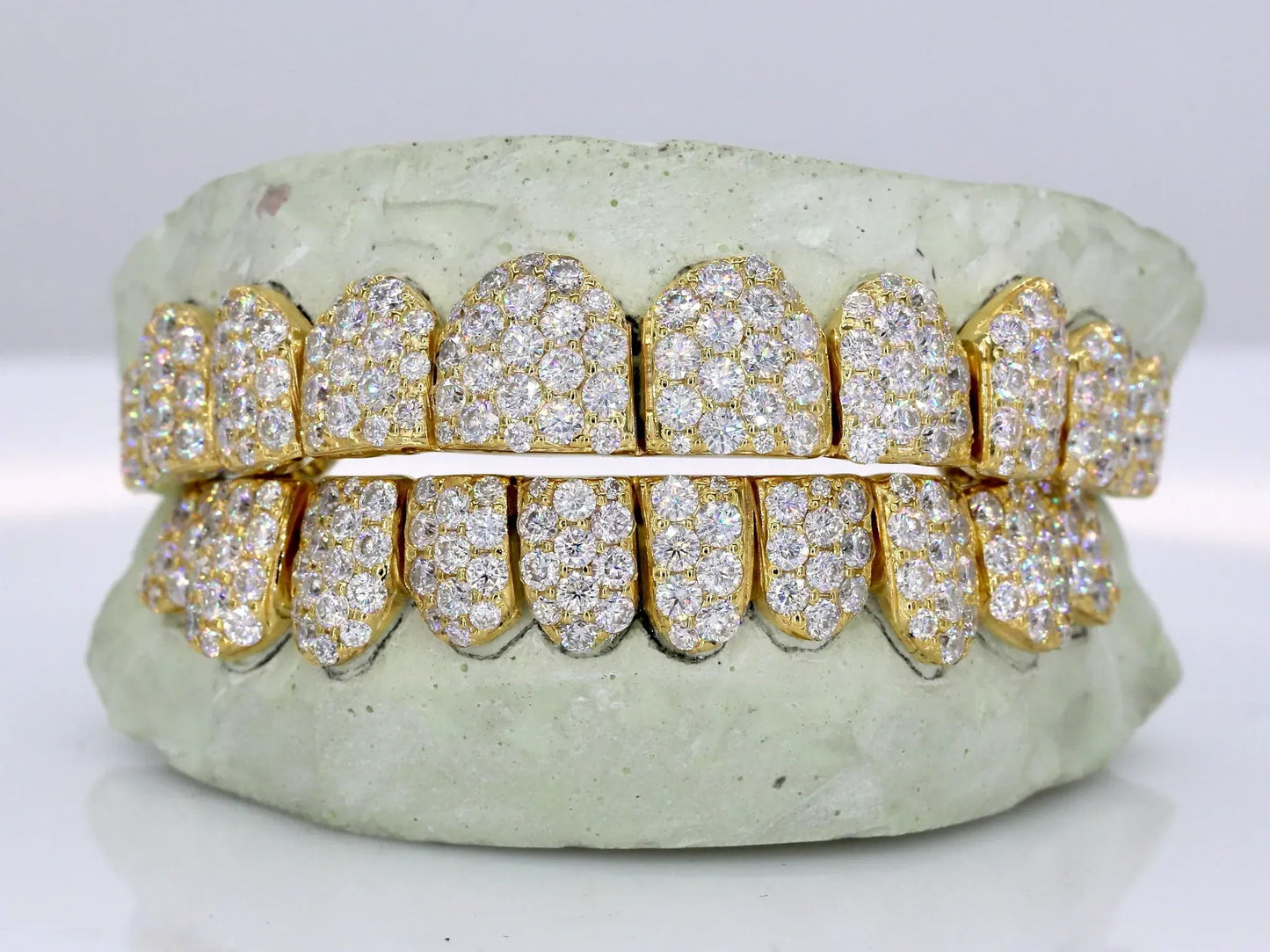 Jumbo VVS Moissanite Diamond Grillz