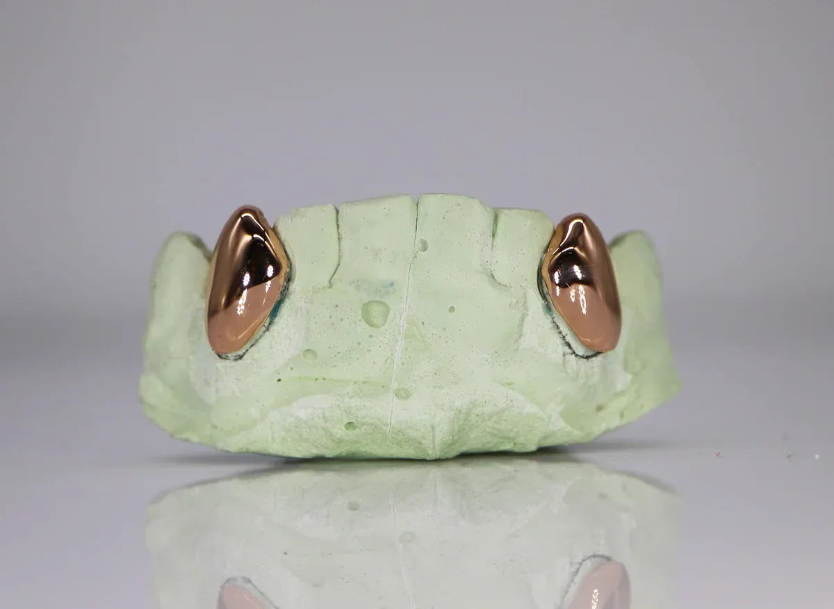 Custom Gold Fangs Grillz