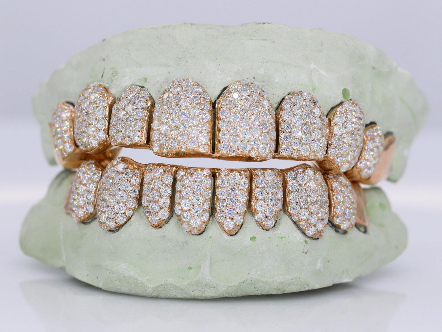10 on 10 Capped VVS Moissanite Diamond Grillz