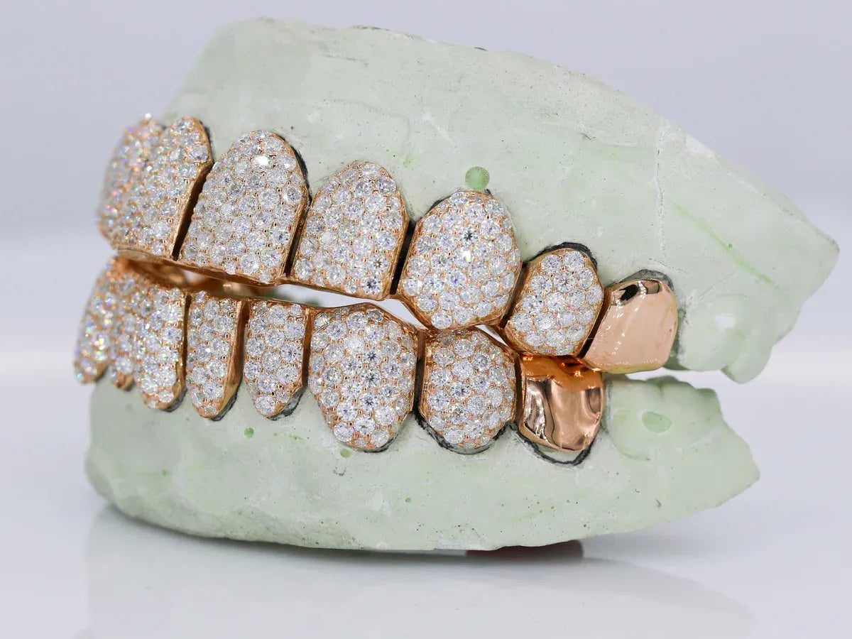 10 on 10 Capped VVS Moissanite Diamond Grillz