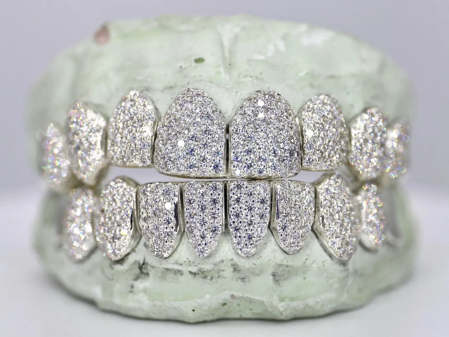10 on 10 Capped VVS Moissanite Diamond Grillz