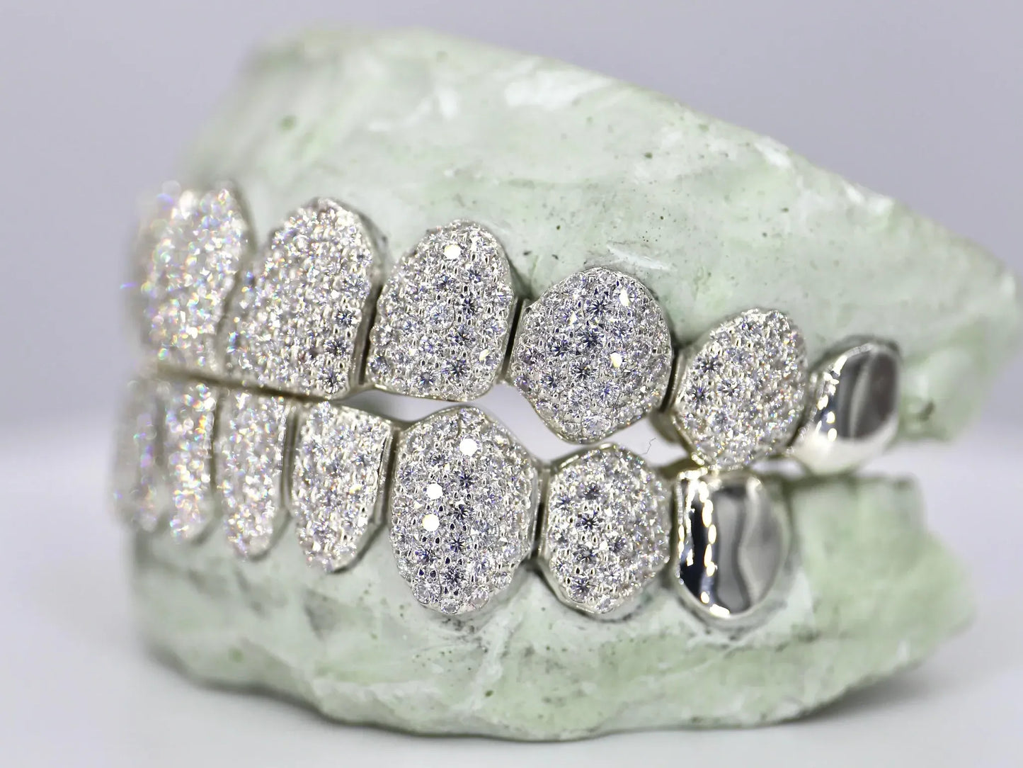 10 on 10 Capped VVS Moissanite Diamond Grillz