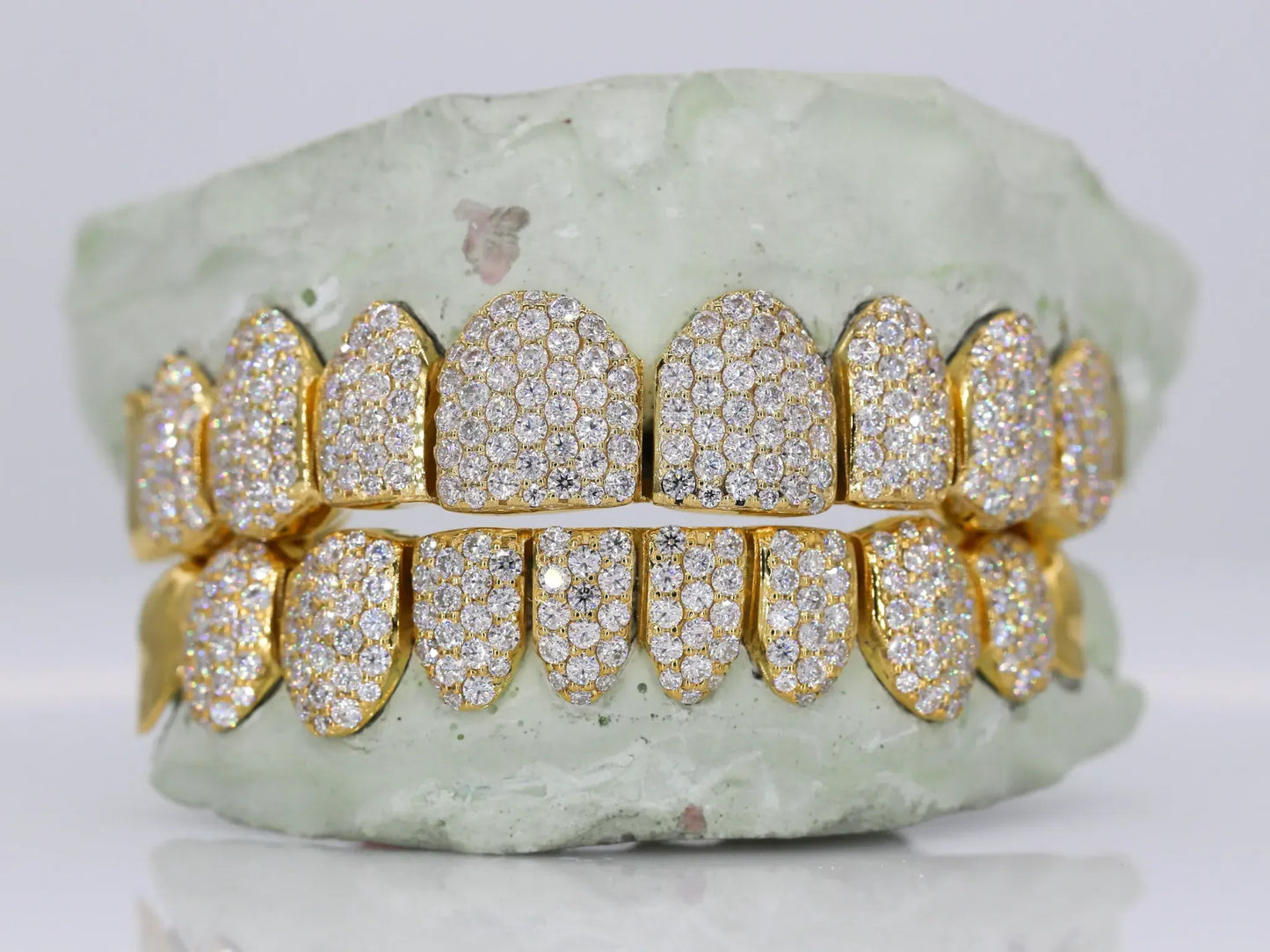 10 on 10 Capped VVS Moissanite Diamond Grillz