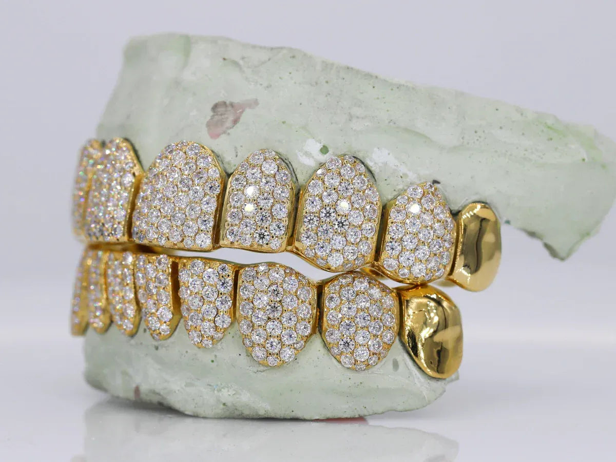 10 on 10 Capped VVS Moissanite Diamond Grillz