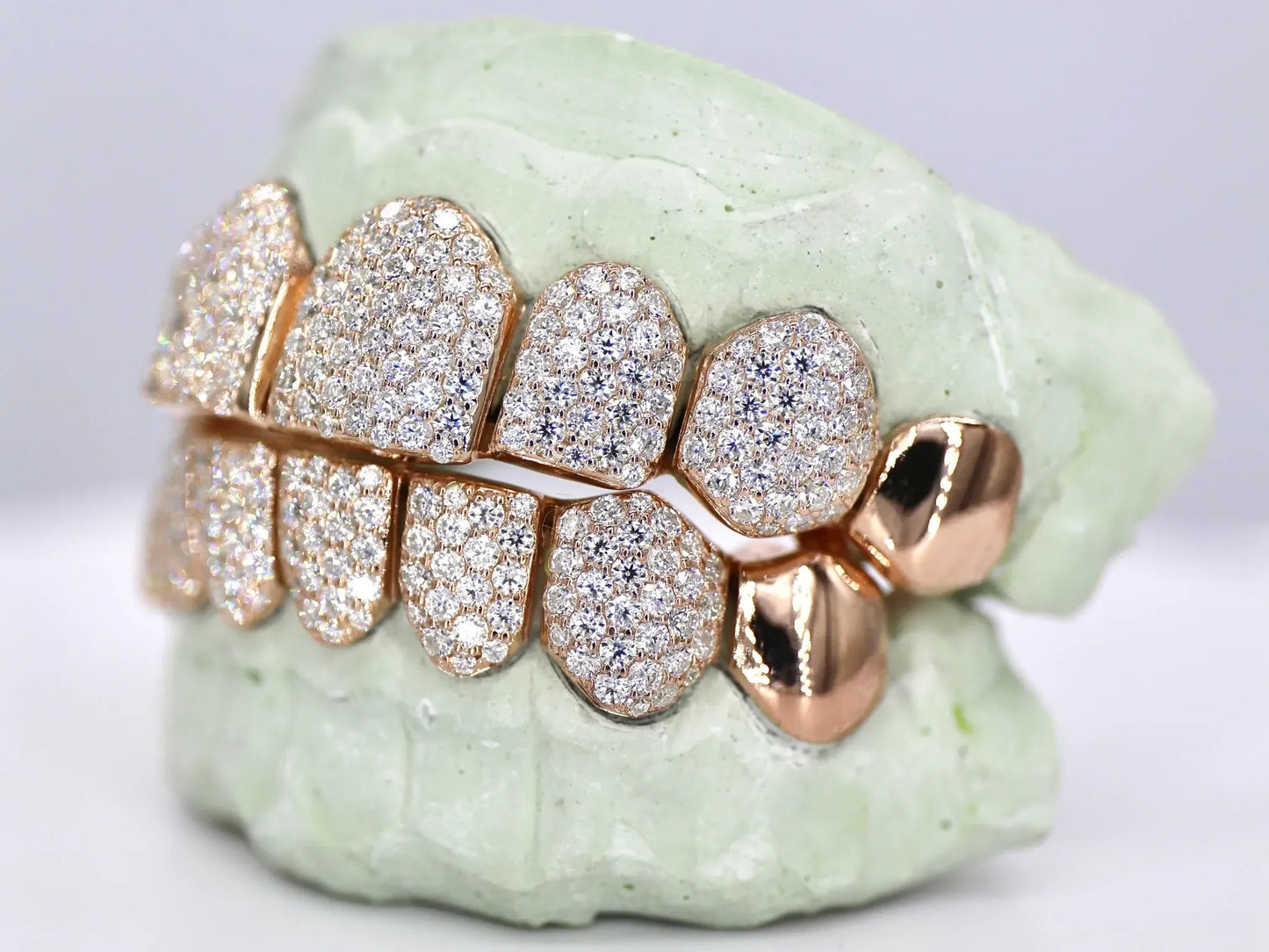 8 on 8 Capped VVS Moissanite Diamond Grillz