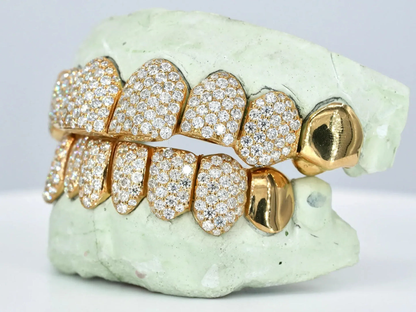 8 on 8 Capped VVS Moissanite Diamond Grillz