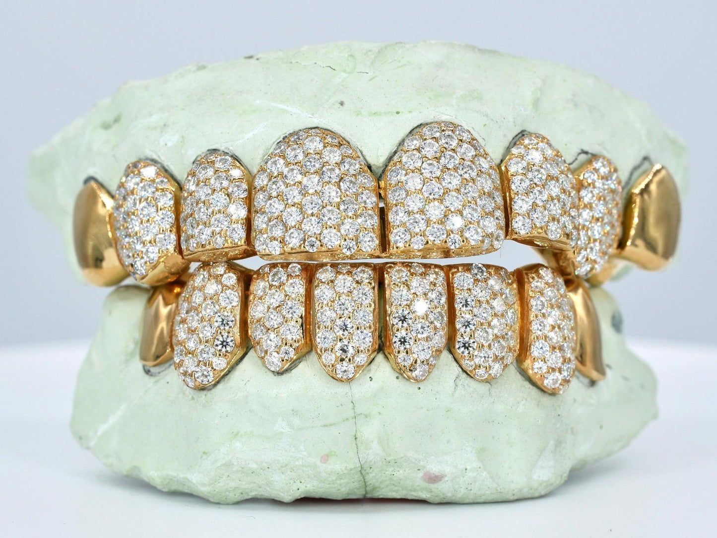 8 on 8 Capped VVS Moissanite Diamond Grillz