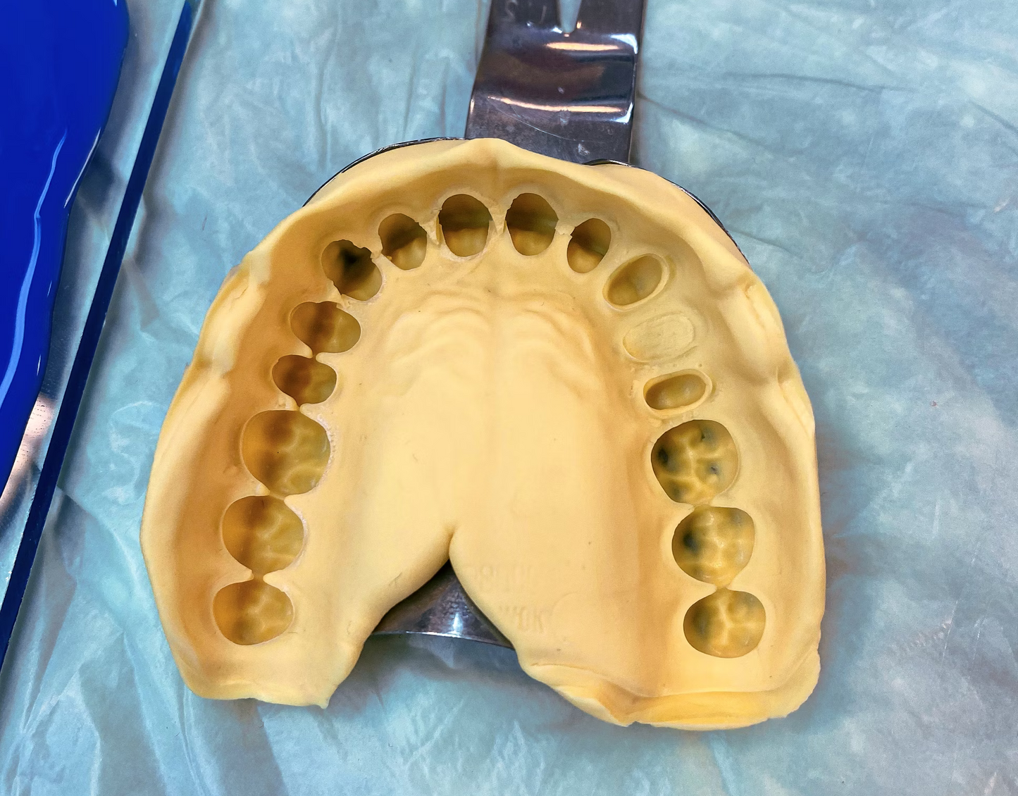 Molding Kits