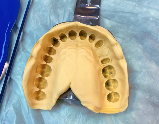 Molding Kits