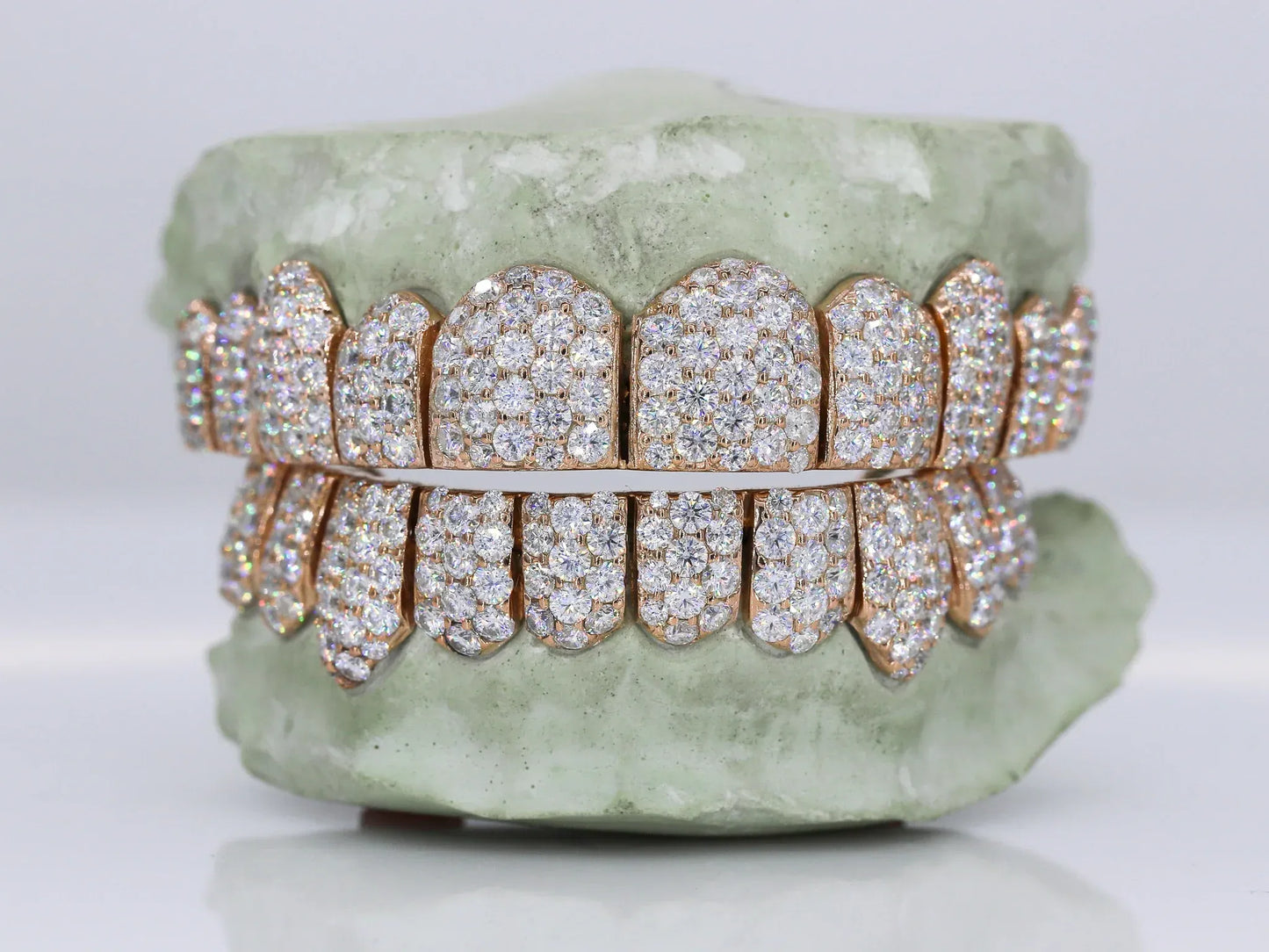 Jumbo VVS Moissanite Diamond Grillz